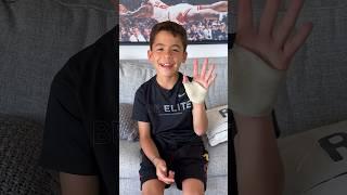 I BROKE MY FIRST BONE...