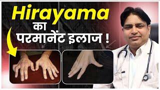 हिरायमा का परमानेंट इलाज  | Ashiyana HealthCare | Dr. Deepak Kumar