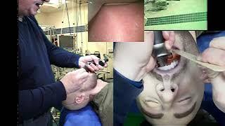 Laryngoscopic Microskills with the standard 7-SIGMA Mannequin