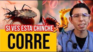 ¿La CHINCHE que da BESOS? Todo sobre enf de CHAGAS |DrPoloGuerrero