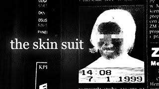 The "Skin Suit" Case