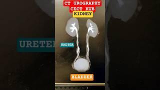urinary system | kidney | ureter | bladder | CT UROGRAPHY | UROGRAM | KUB | #urine #kidneydisease