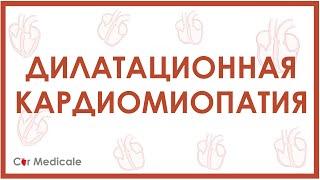 Дилатационная кардиомиопатия - причины, механизмы, симптомы, последствия