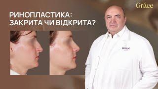 РИНОПЛАСТИКА: ЗАКРИТА ЧИ ВІДКРИТА? | Олег Компанієць | Grace Clinic