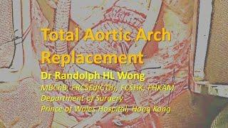 Total Aortic Arch Replacement, Dr Randolph HL Wong ,黃鴻亮醫生