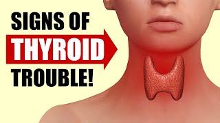 14 Signs Your Thyroid Is In Trouble