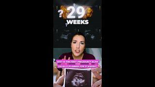 Why is the first pregnancy scan usually planned for 12 weeks?