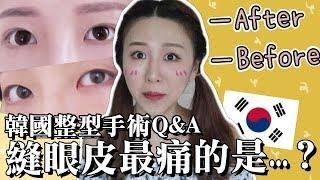 韓國縫雙眼皮Q＆A！！手術最痛的是？如何跟醫生溝通？恢復時間？男朋友的反應？ ｜Lizzy Daily