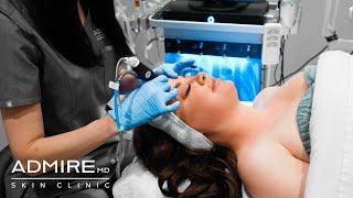 Hydrafacial - AdmireMD Plastic Surgery + Skin Clinic - North Scottsdale
