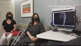 First Coast woman credits new prosthetic procedure at Mayo Clinic for helping her walk comfortably