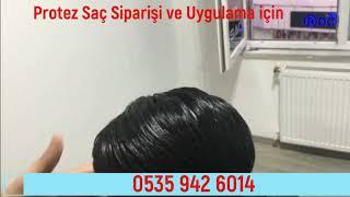 Protez sac Siparisi ve uygulaması için harirprotez