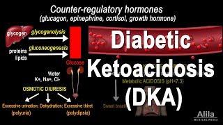 Diabetic Ketoacidosis (DKA) Pathophysiology, Animation