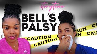 I Can’t Move My Face! Bell’s Palsy Diagnosis