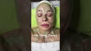 Micro-needling w/ DMK facial by Nyle Lynn #microneedling #enzyme #facial #dmk #selfcare #spaday