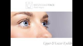 Blepharoplasty Eyelid Surgery in Seattle WA | Joseph Shvidler, MD