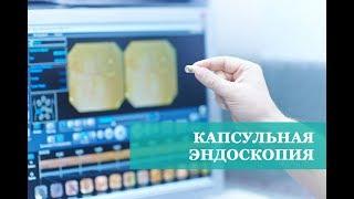 Капсульная эндоскопия. Казань. Клиника КОРЛ