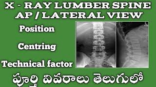 x ray lumber spine position ap lateral view in telugu