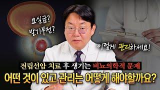 전립선암 치료하신 후에 생기는 여러 비뇨의학적인 증상들! 어떤 것이 있고 관리는 어떻게 해야할까요?