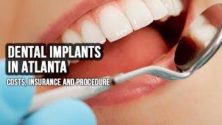 Dental Implants In Atlanta - 3040 Briarcliff Rd NE, Atlanta, GA 30329