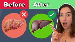 7 Day Liver Detox (Equilife)