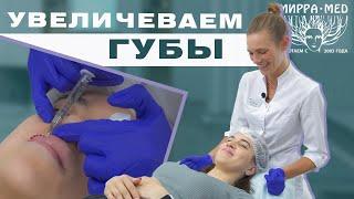 Увеличение губ / КОНТУРНАЯ ПЛАСТИКА ГУБ / Juvederm 1 mg