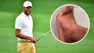 Tony Finau Speaks Out Shocking Injury Update and Event Withdrawal News