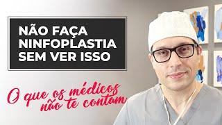 Não faça ninfoplastia sem saber disso!