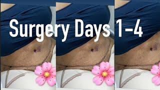 SURGERY VLOG PART 3  (Surgery days 1-4)