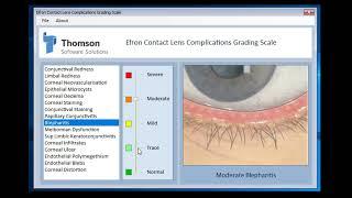 Demo of Efron Grader Tool