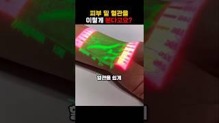 피부 밑 혈관을 이렇게 본다고요?