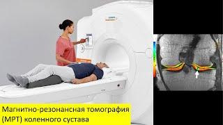 Магнитно-резонансная томография (МРТ) коленного сустава
