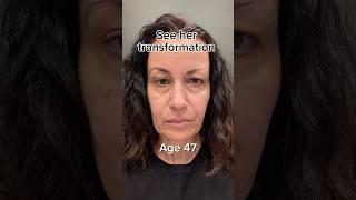 Facelift Naturally | Face Fitness | Face Yoga | Face Massage