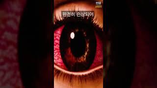 뾰족한 것에 눈이 찔리면 반드시 이렇게 하세요 (모르면 실명됩니다)