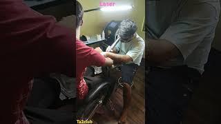 Parmanent Tattoo Remove| Laser Treatment #subcision #lasertherapy #lasersurgery Tattoo Remove #ink