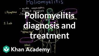 Poliomyelitis diagnosis and treatment | Infectious diseases | NCLEX-RN | Khan Academy