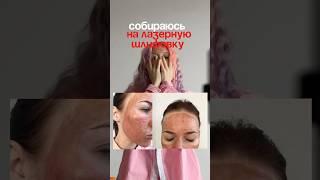 ЛАЗЕРНАЯ ШЛИФОВКА ЛИЦА #acnescars #skincareroutine #лазернаяшлифовка