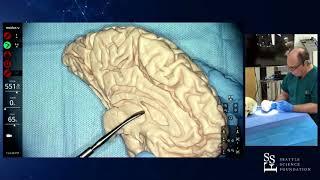 Live Demo: Practical Anatomy of the Brain: Sulci & Gyri - Guilherme Carvalhal Ribas, MD