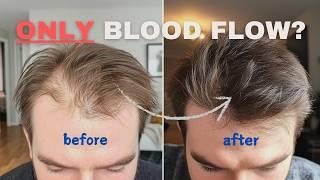 Does MORE BLOOD FLOW Increase Hair Growth?