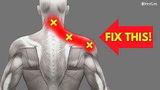 How to INSTANTLY Fix Pinched Nerve Pain in the Neck and Shoulders