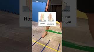 Упражнение для лечения и профилактики ВАЛЬГУСНОЙ ДЕФОРМАЦИИ СТОПЫ #вальгус#плоскостопие#больвнога×#