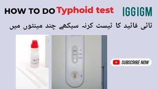 Typhoid test IgG IgM Positive