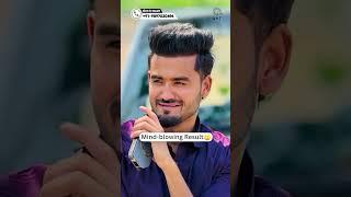 Youtuber Bilal Rajput Hair Transplant Result #shorts#hairtransplant
