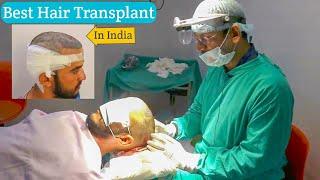 Indias Best Hair Transplant Clinic || After Hair Transplant Surgery