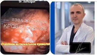 Остановка кровотечения из желудка. Язва желудка. #shorts #trending #viral #youtubeshorts #freefire