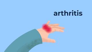 natural ways to Manage Arthritis #HealthTube