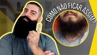 3 PASSOS PARA TER A BARBA DOS SONHOS!