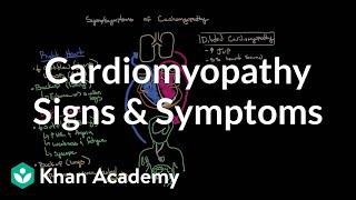 Cardiomyopathy signs and symptoms | Circulatory System and Disease | NCLEX-RN | Khan Academy