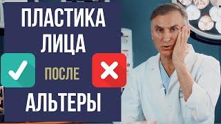 КРУГОВАЯ ПОДТЯЖКА ЛИЦА  ПОСЛЕ СМАС ЛИФТИНГ АЛЬТЕРА  РЕАЛЬНО⁉️