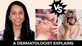 Chemical Peels At Home Vs Professional Chemical Peels | Chemical Peel Benefits