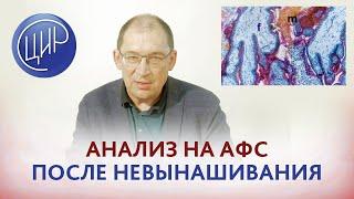 Обследование при невынашивании беременности. АФС, иммунный фактор.